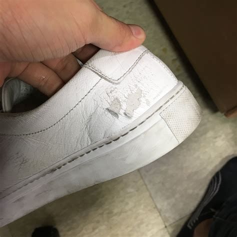 white leather shoes peeling